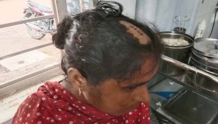 দুর্গাপুরে জমি সংক্রান্ত বিরোধের জেরে নারীকে কুপিয়ে জখম